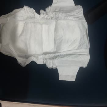 Yenidoğan Bebek Bezlerinde Kopan Bantlar Ve Eksik Ürün Mağduriyeti