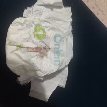 Yenidoğan Bebek Bezlerinde Kopan Bantlar Ve Eksik Ürün Mağduriyeti