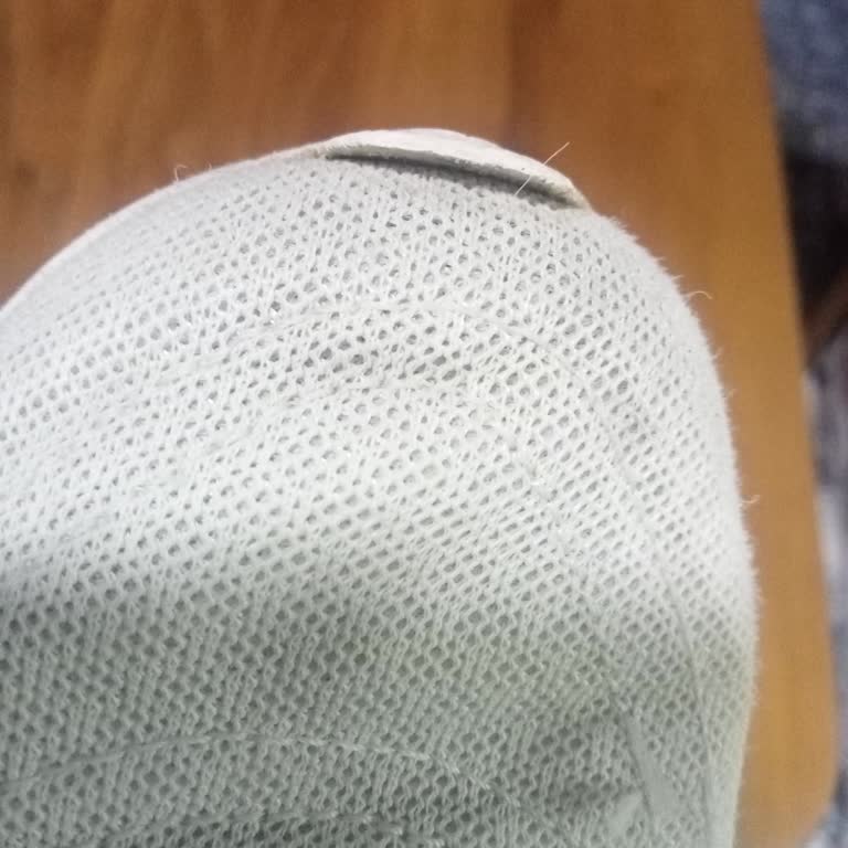 Adidas Spor Ayakkabısında Kısa Sürede Yırtılma Ve İade Talebinin Reddedilmesi