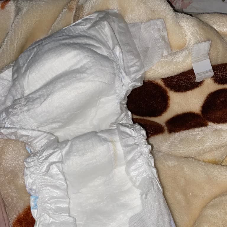 Molfix Mavi Paket Bebek Bezlerinde Sürekli Sızdırma Ve Bant Kopması Sorunu