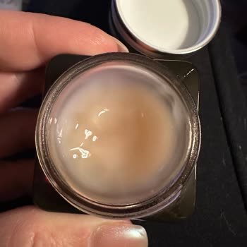 Göz Altında Yağ Bezeleri Ve Yanma Yapan Ürün Nedeniyle Mağduriyet