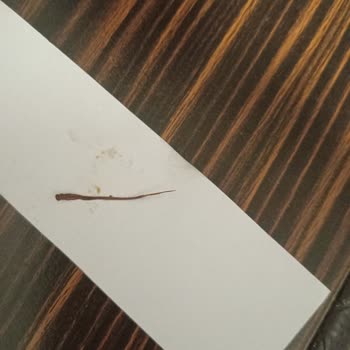 Çiğköfte Siparişimde Böcek Ayağına Benzer Yabancı Maddeyle Karşılaştım