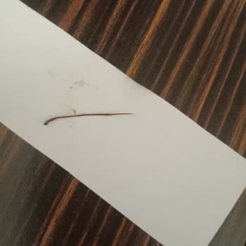 Çiğköfte Siparişimde Böcek Ayağına Benzer Yabancı Maddeyle Karşılaştım