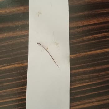 Çiğköfte Siparişimde Böcek Ayağına Benzer Yabancı Maddeyle Karşılaştım