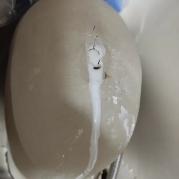 Koçtaş Kırık Ve Tamir Edilmiş Klozet Takımı Yeni Diye Satıldı