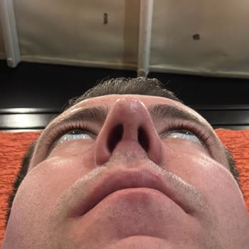 Burun Estetiği Sonrası Mağduriyet Ve İlgisizlik