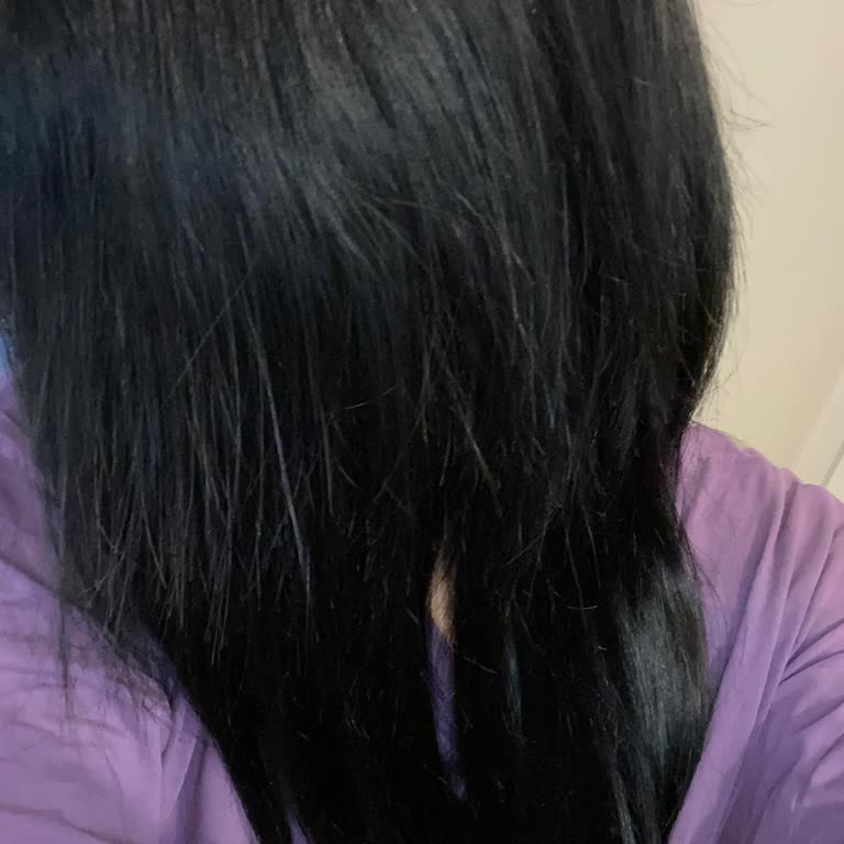 Caner Yetiker Hair Artist Kaynak Saç İşlemi Sonrası Saç Dökülmesi Ve Mağduriyet!