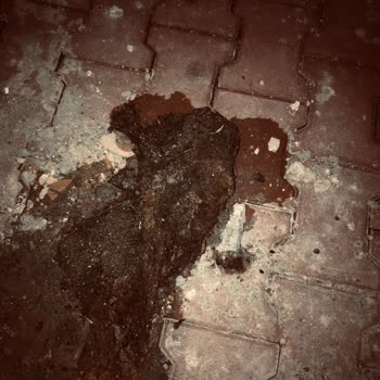 Tıkanıklık Açılmadan Alınan Yüksek Ücret Ve Eksik Hizmet Mağduriyeti