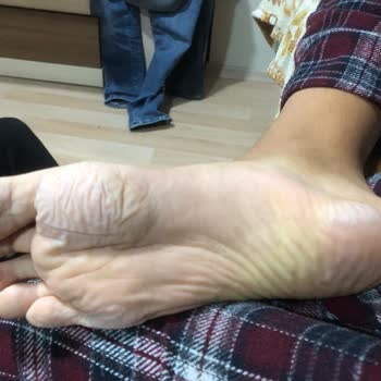 Aldığım Çocuk Botu Ayağını Tahriş Etti, İade Veya Değişim Talebim Reddedildi