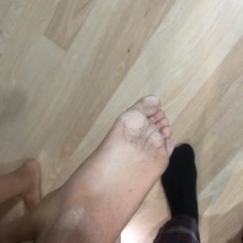Aldığım Çocuk Botu Ayağını Tahriş Etti, İade Veya Değişim Talebim Reddedildi