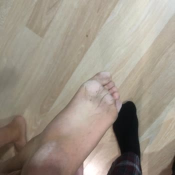 Aldığım Çocuk Botu Ayağını Tahriş Etti, İade Veya Değişim Talebim Reddedildi