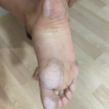 Aldığım Çocuk Botu Ayağını Tahriş Etti, İade Veya Değişim Talebim Reddedildi