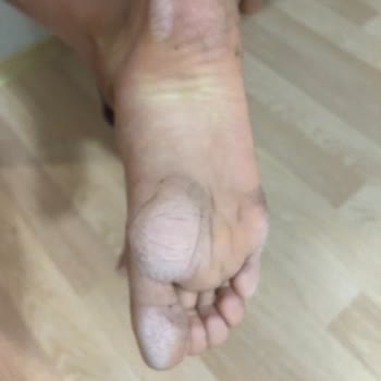 Aldığım Çocuk Botu Ayağını Tahriş Etti, İade Veya Değişim Talebim Reddedildi