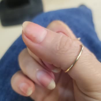 Essence Oje Zor Çıkıyor Ve Tırnakta Leke Bırakıyor