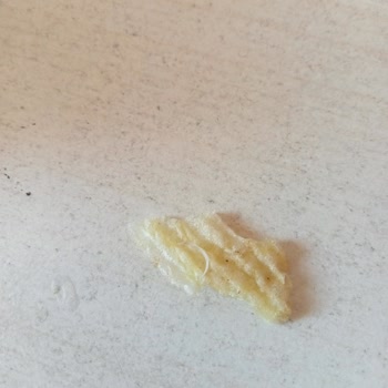 Cips Paketinde Tırnak Parçası Buldum Sağlığım Riske Girdi Üretim Süreci İncelensin