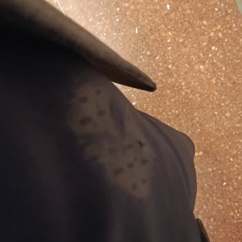 Arızalı Ütü Nedeniyle Takım Elbisemin Yanması Ve Otel Yetkililerinin İlgisizliği