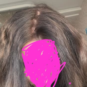 Saloon Veysel Kuaför Yanlış Saç Rengi Uygulaması Sonrası Mağduriyet Ve Beklenmedik Ücret Talebi