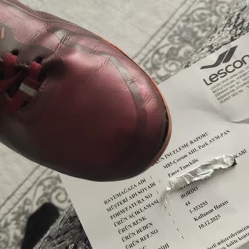 Garantili Krampon Kısa Sürede Bozuldu, Çözüm Sunulmadı