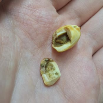 Migros Hemen Siparişinden Aldığım Fıstık Kurtlu Çıktı: Çocuğuma Güvenle Ürün Almak İsterdim