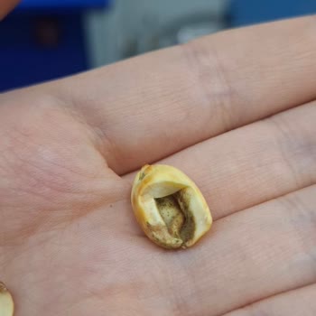 Migros Hemen Siparişinden Aldığım Fıstık Kurtlu Çıktı: Çocuğuma Güvenle Ürün Almak İsterdim