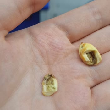 Migros Hemen Siparişinden Aldığım Fıstık Kurtlu Çıktı: Çocuğuma Güvenle Ürün Almak İsterdim