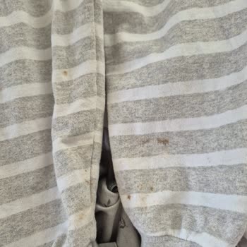 Beko Çamaşır Makinemin Arızası Defalarca Servise Rağmen Çözülemedi