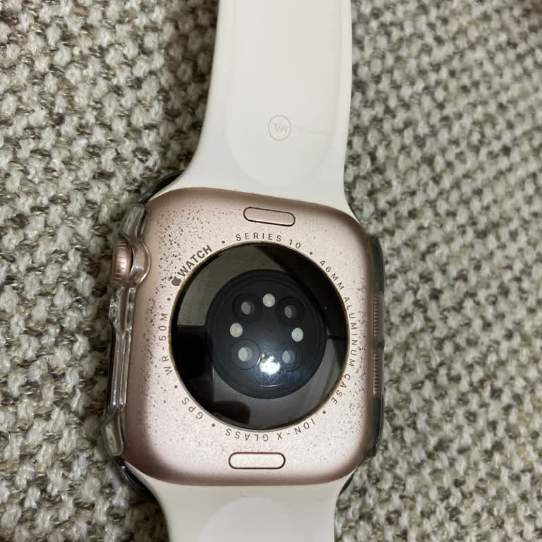 Apple Watch Kasasında Kendiliğinden Oluşan Soyulmalar Garanti Kapsamında Çözülmeli