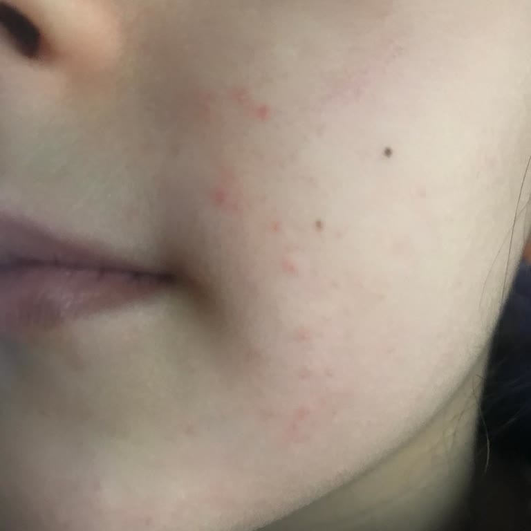 Köpük Sabun Beklerken Sıvı Hayal Kırıklığı: Çocuğumun Sağlığı İçin Endişeliyim