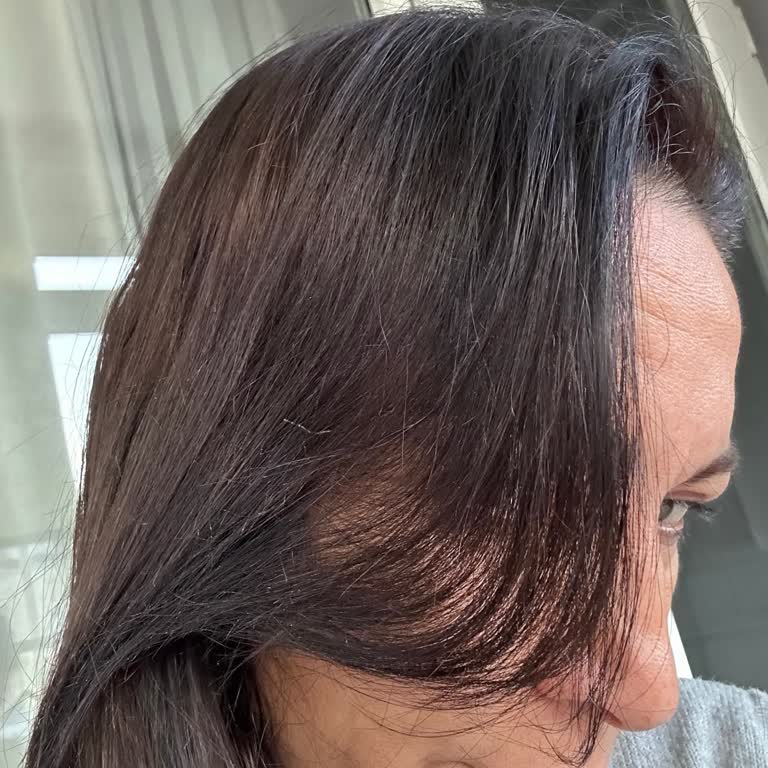 Aldığım Saç Boyası Beklenenden Çok Koyu Çıktı, Mağduriyet Yaşadım