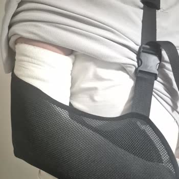 Puma Ayakkabının Kaygan Tabanı Nedeniyle Yaşadığım Ciddi Sakatlık