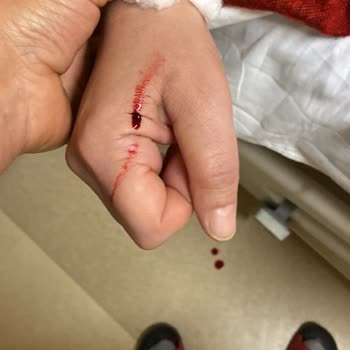 Konya Şehir Hastanesi Jinekoloji Servisinde Hemşire Yaklaşımı Ve Hasta Hakları İhlali