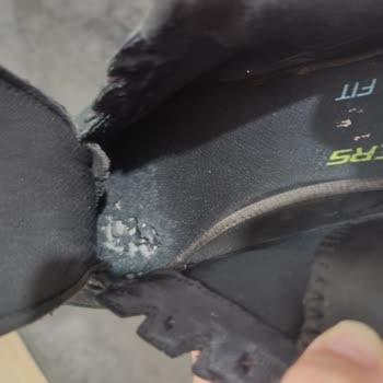 6 Ayda Yırtılan Skechers Ayakkabı İçin Garanti Reddi Mağduriyet Yarattı