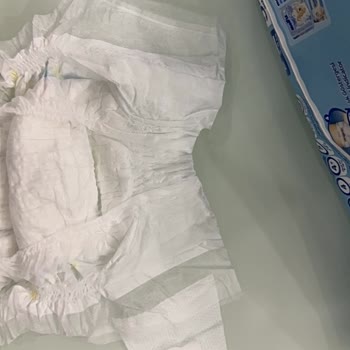 Molfix Bebek Bezinde Üretim Hatası, Eksik Ve Bantsız Ürünler Güvenimi Sarstı