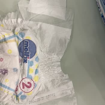 Molfix Bebek Bezinde Üretim Hatası, Eksik Ve Bantsız Ürünler Güvenimi Sarstı