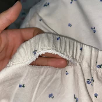 H&M Siparişim Yırtık Geldi Müşteri Hizmetlerine Ulaşamıyorum