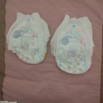 Molfix 5 Numara Külot Bezde Farklı Boyut Sorunu: Çocuğumun Sağlığı Ve Güvenliği Tehlikede