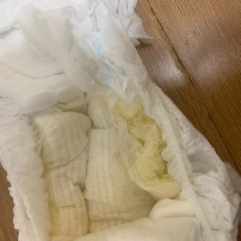 Molfix 5 Numara Bezde Ani Kalite Sorunu Ve Mağduriyet