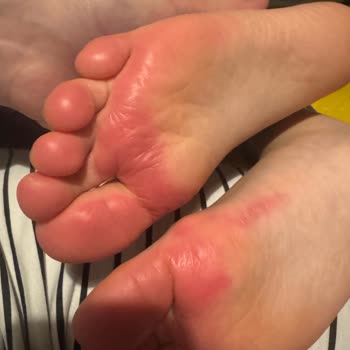 Su Geçirmez Diye Aldığım Bot Kısa Sürede Su Aldı Çocuğumun Ayağında Yara Ve Koku Oluştu