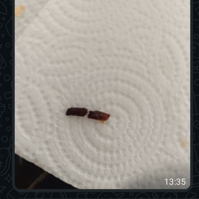 Tahtakale Spot Aldığım Ekmeğin İçinden Yabancı Bir Cisim Çıktı!