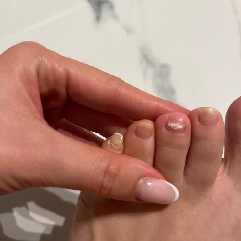 Pedikür Sonrası Tırnak Kaybı Ve Hijyen Sorunu Nedeniyle Mağduriyet Yaşadım