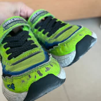 Kısa Sürede Deforme Olan Ayakkabıya Garanti Desteği Bekliyorum