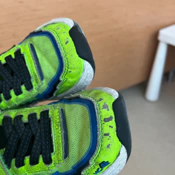 Kısa Sürede Deforme Olan Ayakkabıya Garanti Desteği Bekliyorum