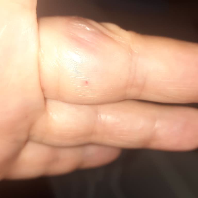 Tava Ve Tencere Sapları Aşırı Isınıyor, Kullanımda Güvenlik Riski Oluşuyor