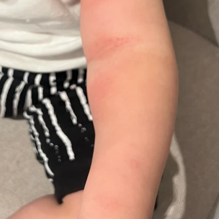 Medicana Sağlık Grubu Yanlış Tedaviyle Oğlumun Kolu Şişti