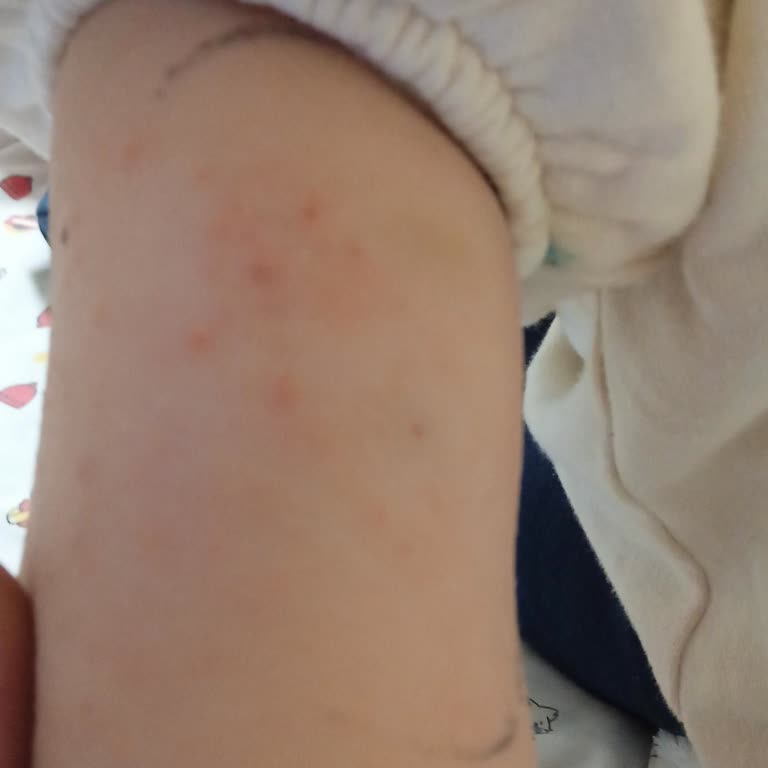 Sibionics Sensör İlk Günden Arızalı Çıktı Çocuğumun Sağlığını Riske Attı