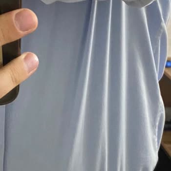 Kısa Sürede Yırtılan Gömlek Ve Yetersiz Ürün Kalitesi Nedeniyle Hayal Kırıklığı