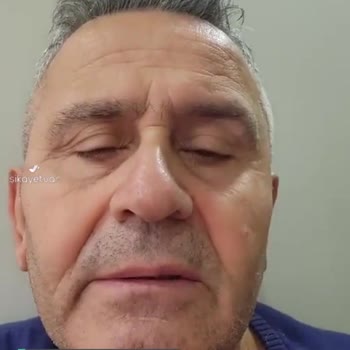 Nissan Frenlerdeki Cızırtı Sesi