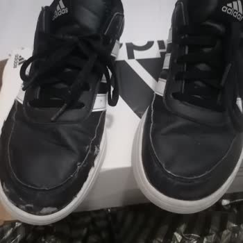 Adidas Ayakkabının Tekinde Deri Soyulması Ve Kullanıcı Hatası Yanıtı