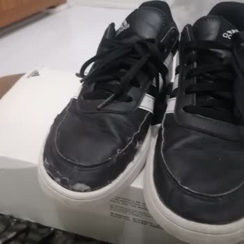 Adidas Ayakkabının Tekinde Deri Soyulması Ve Kullanıcı Hatası Yanıtı