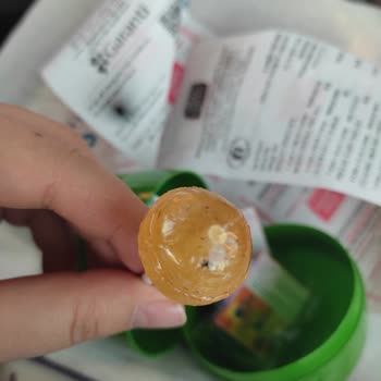 Toybox Sürpriz Yumurtadan Çıkan Hijyen Skandalı